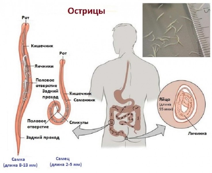 Виды паразитов в организме человека