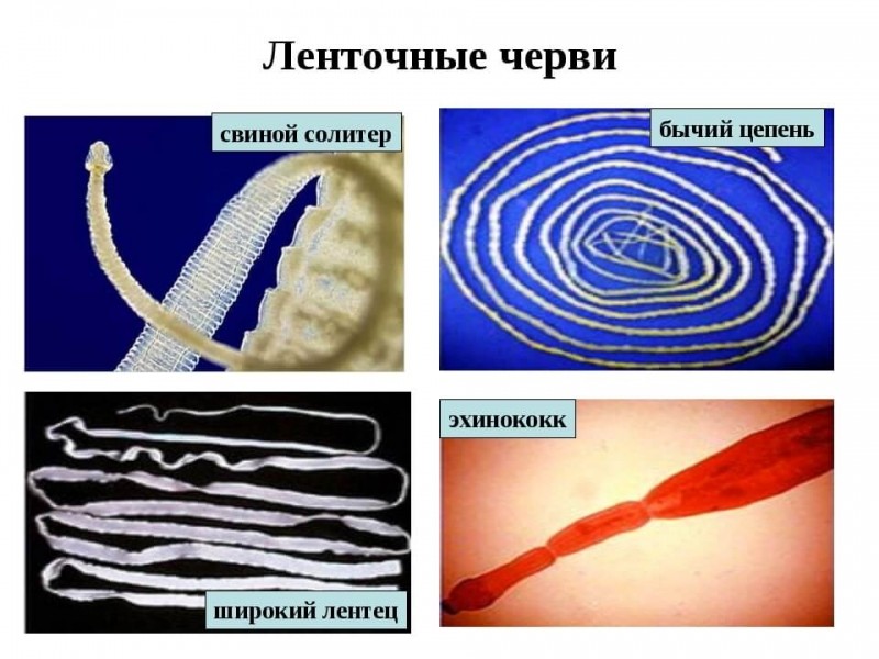 Симптомы ленточных червей у человека