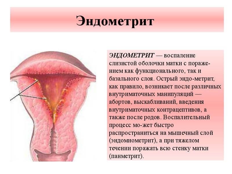 Норма ureaplasma parvum у женщин