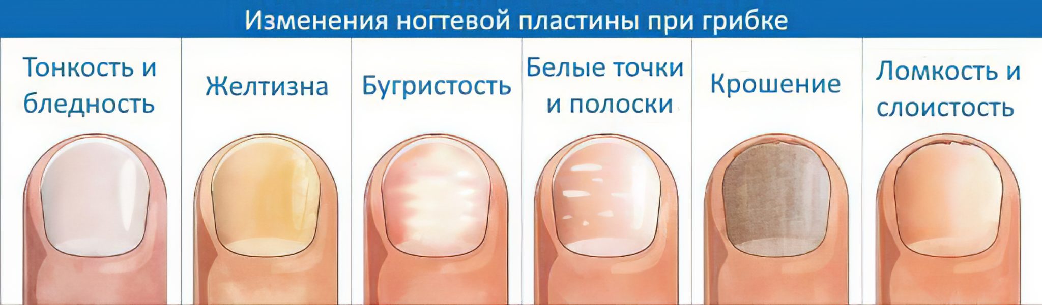 Проблема с ногтями к какому врачу обратиться